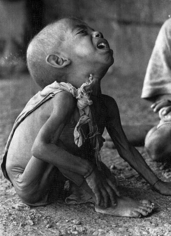 کودکی در مرکز تغذیه آلاماتا در دوران قحطی اتیوپی. اکتبر سال 1984. این تصویر دلخراش باعث راه افتادنِ پویش کمک شد و جایزه مطبوعات بریتانیایی برای بهترین عکس سال را دریافت کرد. 
