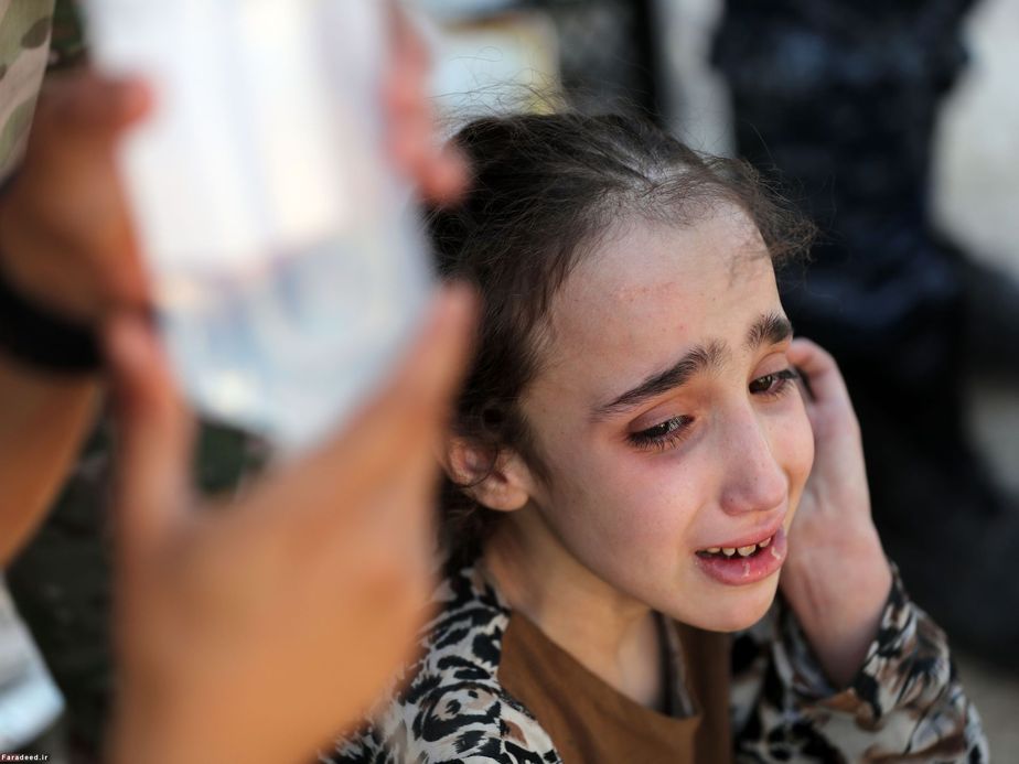 دختر زخمی و آواره عراقی در جنوب موصل