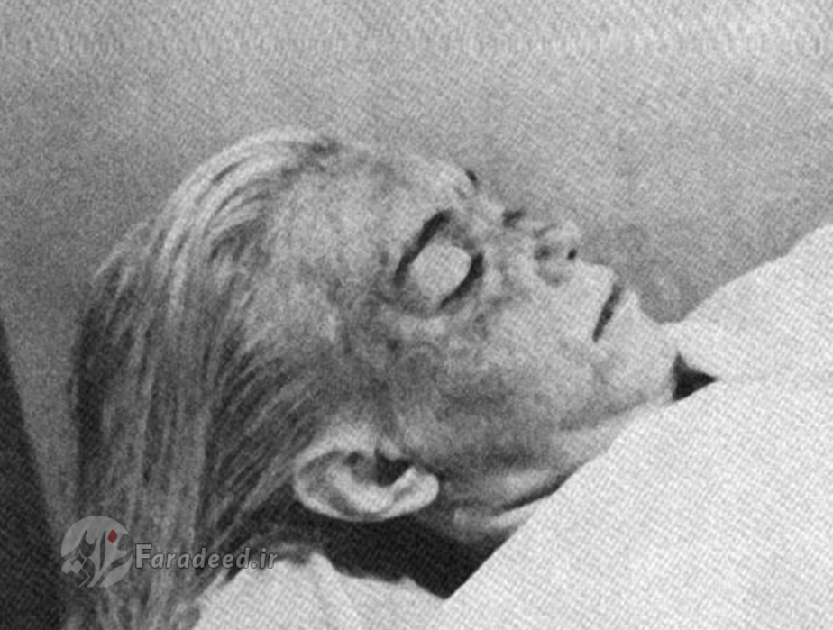 عکس منتسب به جسد بی جان مرلین مونرو در چزشکی قانونی. آگوست 1962