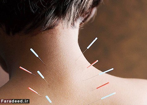 9 روش برای تسکین درد گردن