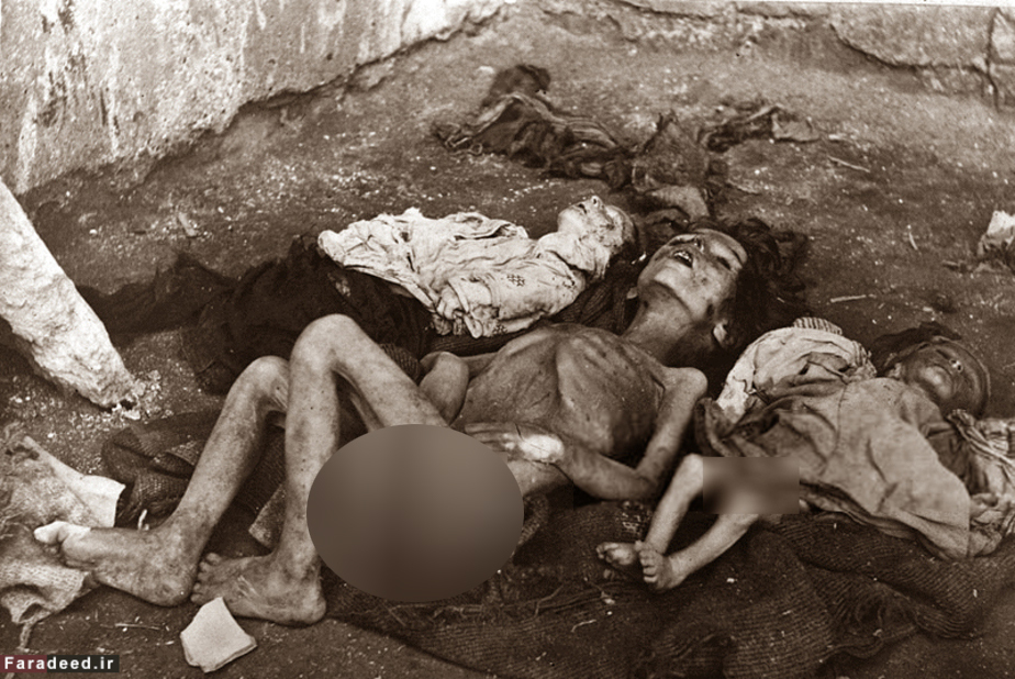  جسد یک کودک ارمنی قربانی نسل کشی. سال 1915
