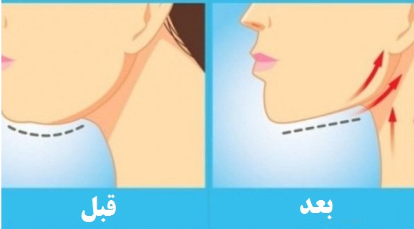 ۷ ترفند برای زیبا شدن